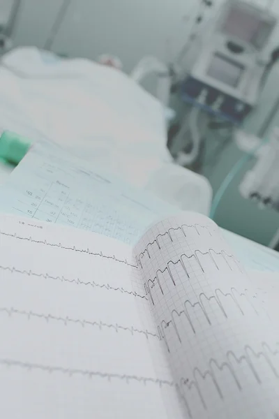 EKG v pokoji pacienta, lékařské vzdělání — Stock fotografie