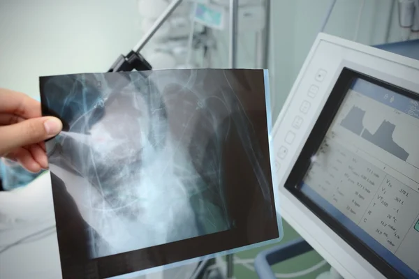 Radiografía en la mano del médico a la cabecera del paciente — Foto de Stock