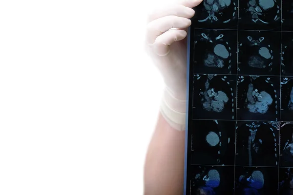 Компьютерная томография в руках врача, изолированная на белом фоне со спецэффектом — стоковое фото