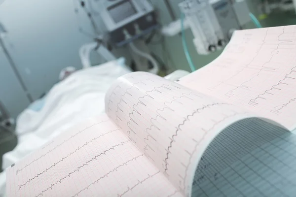 ECG en el fondo del paciente mentiroso — Foto de Stock