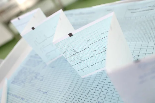 Línea Ecg Sobre Electrocardiografía Papel Una Sala Clínica —  Fotos de Stock