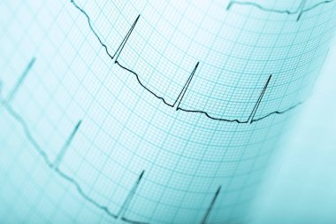 Mavi grafik kağıdında ECG çizgisi olan tıbbi arkaplan