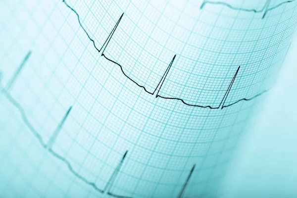 Mavi grafik kağıdında ECG çizgisi olan tıbbi arkaplan