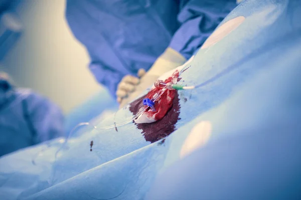 Sang Patient Sur Tissus Stériles Contre Groupe Fond Chirurgiens Assis — Photo