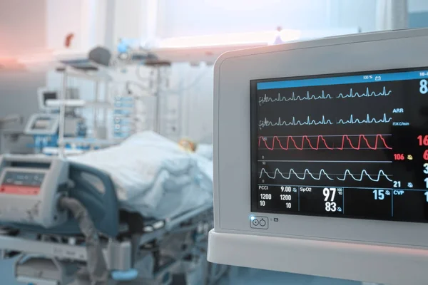 Herzmonitor Mit Ekg Leitungen Vor Dem Hintergrund Eines Kritischen Patienten — Stockfoto