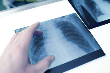 Doktor ofisindeki ışık kutusundaki hasta verilerini inceliyor..