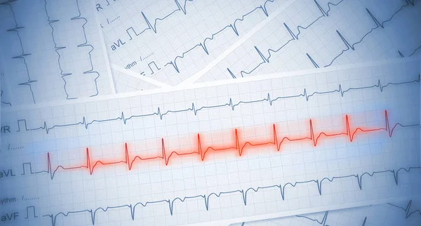 Fondo Medico Con Carta Ecg Con Linea Battito Cardiaco Rosso — Foto Stock