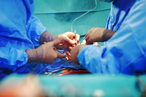 Группа Хирургов Выполняющих Хирургическую Операцию Больнице — стоковое фото