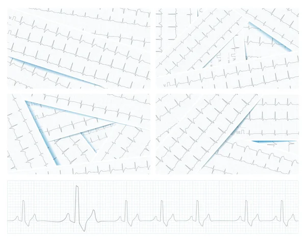 Verstreute Ekg Diagramme Als Hintergrund Des Gesundheitswesens Vektor — Stockvektor