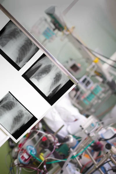 Yoğun Bakımdaki Dizinin Arka Planında Röntgen Görüntüleri Var — Stok fotoğraf