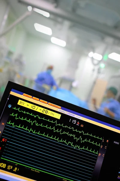 Monitor Cardíaco Quirófano Del Hospital — Foto de Stock