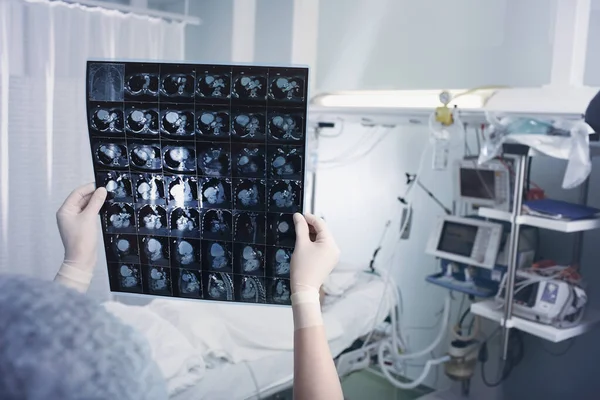 Médica Olhando Para Ressonância Magnética Contra Paciente Deitado Cama Unidade — Fotografia de Stock