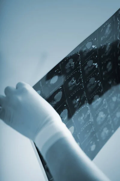 Médica Feminina Segurando Tomografia Computadorizada Mão Enluvada — Fotografia de Stock