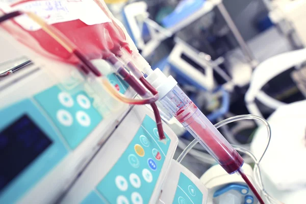 Переливание крови в реанимации — стоковое фото
