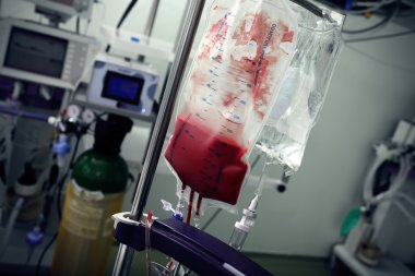 birçok tıbbi ekipmanları ile ward ortasında kan torbası