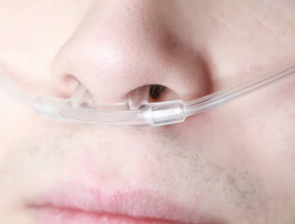 Oxygen lines in the nose of an asthmatic — Stock Photo, Image