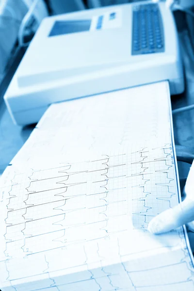 Registrazione cardiogramma in ospedale — Foto Stock
