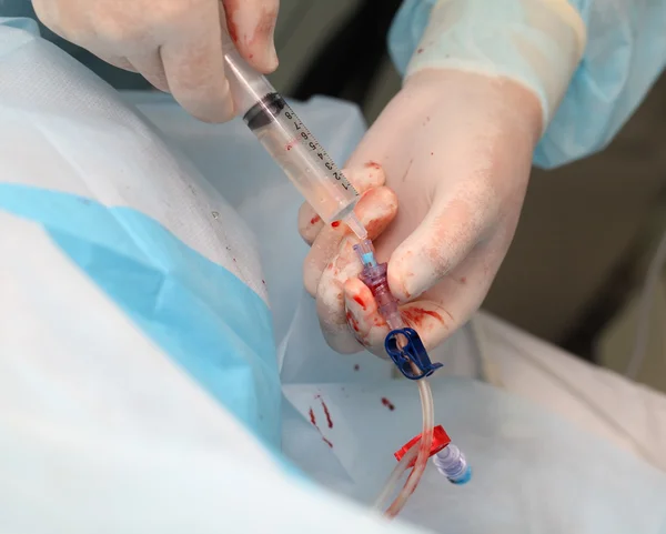 Doctor works with the patient's catheter. close-up photo — Stock Photo, Image