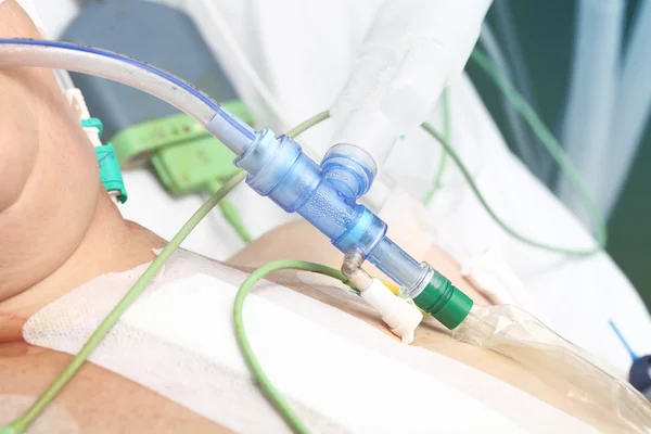 Detail of respiratory equipment on patient — Stock Photo, Image