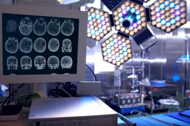Nöroşirürji ameliyathane hastanın Tomogram 