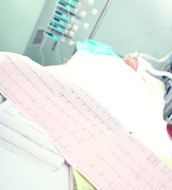 Elektrokardiyogram hastalar