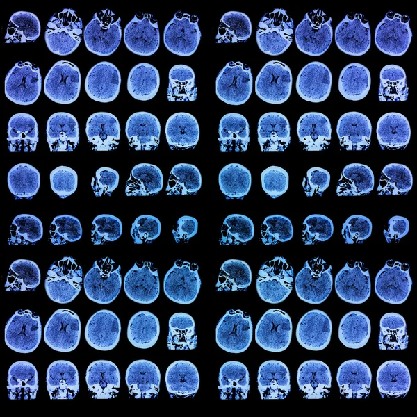 Foto der medizinischen Tomographie. Hintergrund — Stockfoto