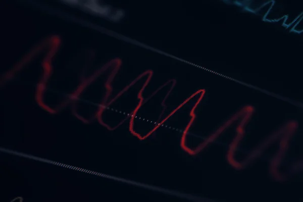 Close-up of the curve on the medical monitor — Stock Photo, Image