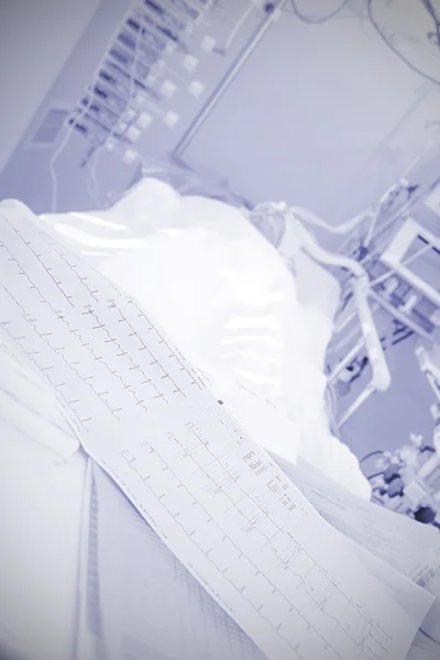 Ataque cardíaco na UCI. ECG paciente pesado ao lado da cama — Fotografia de Stock