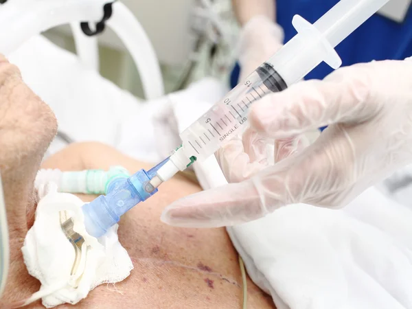 Serviço médico (de enfermagem) pacientes gravemente enfermos na UTI — Fotografia de Stock