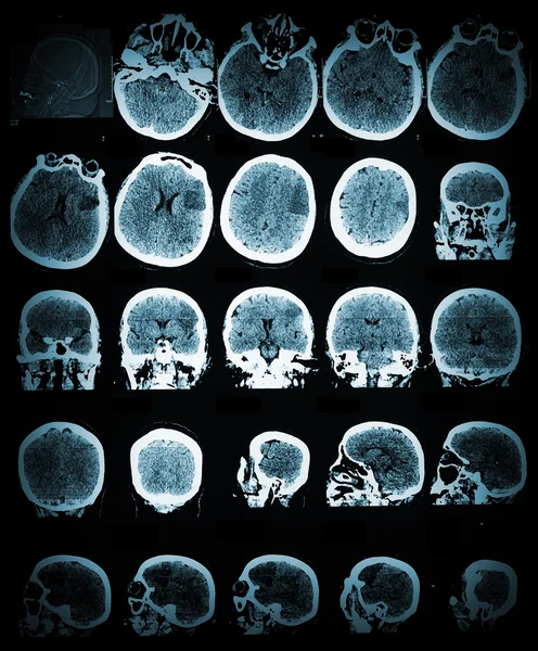 Gezondheidszorg en medische behang met de Ct-scan afbeelding — Stockfoto