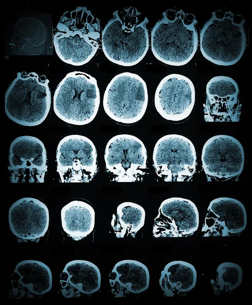 Zdravotní péči a lékařské tapeta s Ct scan image — Stock fotografie