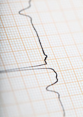 EKG izole makrofoto izler