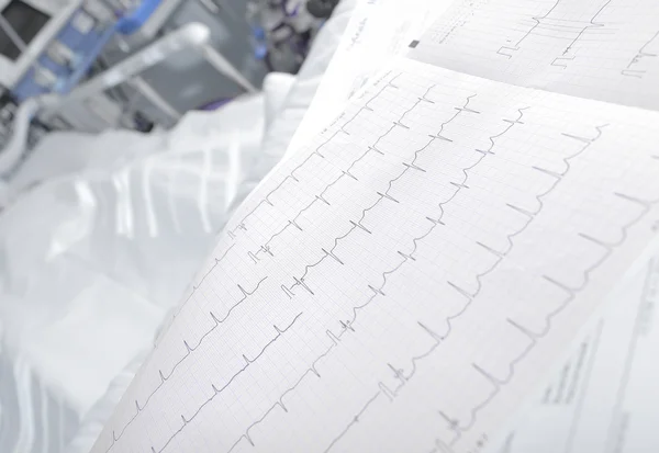 ECG chart in the ward closeup — Stock Photo, Image