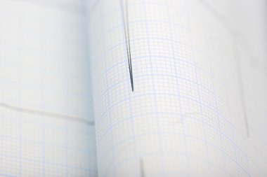 Grafik yakın çekim tıbbi geçmişi