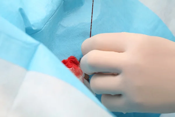 Surgeon job  in the operating room — Stock Photo, Image