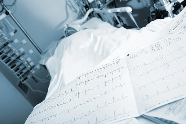 ЭКГ на кровати пациента в часах наблюдения — стоковое фото