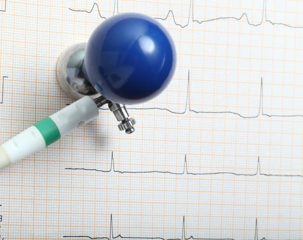 EKG elektrodu ve grafik — Stok fotoğraf