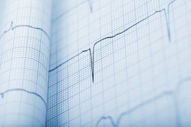 EKG arka planda tek renkli