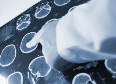 Doktor puan parmak tarama resmi