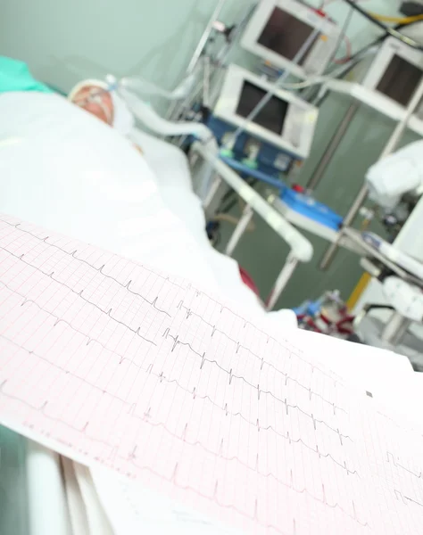 EKG bed patient övervakning koncept — Stockfoto