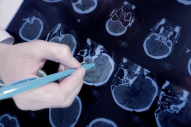 close-up of the doctor hand pointing to the brain CT clipart