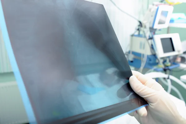 X-Ray in arts handen in het ziekenhuis — Stockfoto