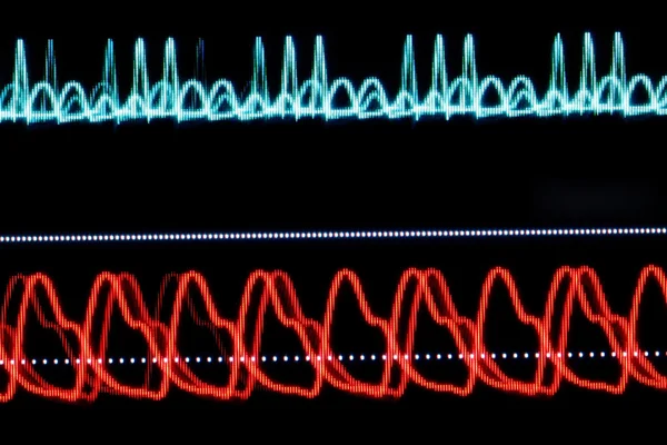 ECG graph on the monitor pixelated — Stock Photo, Image