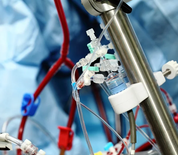 Aparelhos de circulação sanguínea artificial na unidade de terapia intensiva — Fotografia de Stock