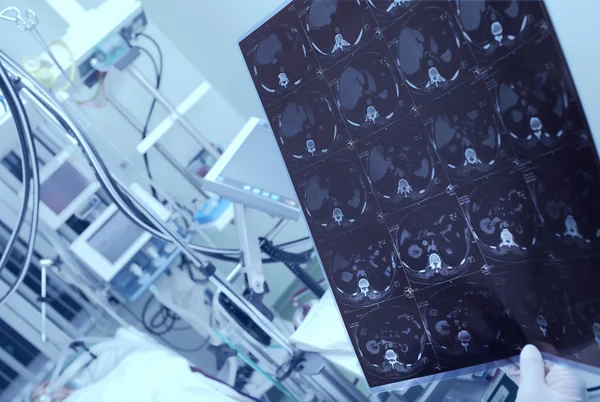 Врач рассматривает компьютерную томографию тяжелого пациента в больнице — стоковое фото