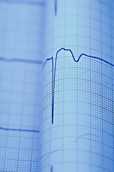 ECG macro as a medical diagnostic concepts — Stock Photo, Image