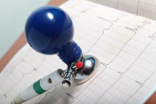 Diagnósticos de ECG en el escritorio del médico — Foto de Stock