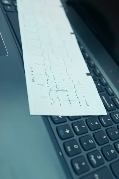 Pojęcie medyczne klawiatury EKG i Pc — Zdjęcie stockowe