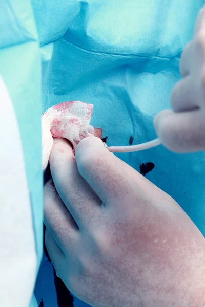 Doctor conducting the procedure with hands close-up concept work — Stock Photo, Image