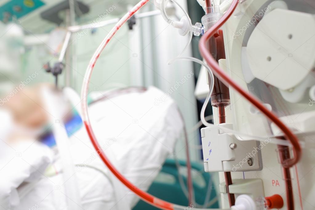 Patient on cardiopulmonary bypass device in the intensive care